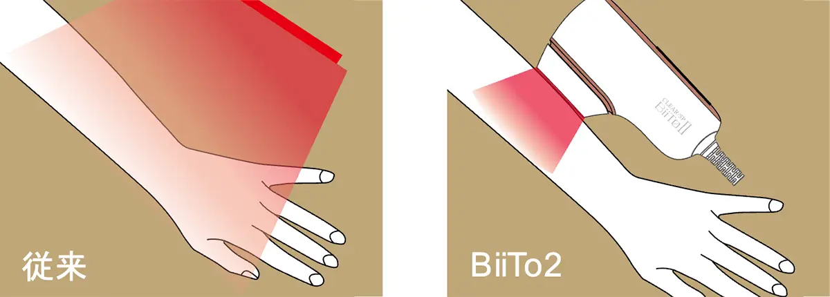 従来の家庭用脱毛機との照射方法の違いを解説したイラスト図