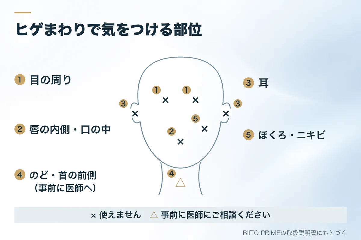 ヒゲまわりで気をつける部位の図。使えない部位：目の周り、唇の内側・口の中、耳、ほくろ・ニキビ。事前に医師へ：のど・首の前側