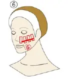 顔への照射:頬横からこめかみにかけて照射